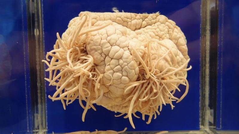 Amiba mâncătoare de creier - parazitul care se hrănește cu materia cenușie