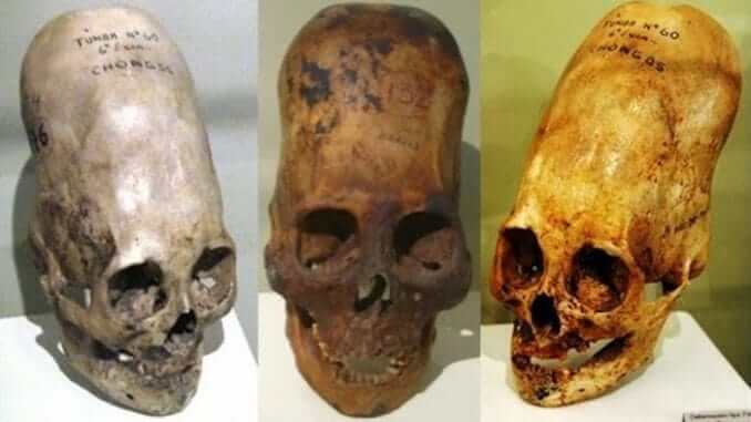 Misterul craniilor alungite din Peru a fost rezolvat. Ce au descoperit cercetătorii