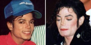 De ce pielea lui Michael Jackson a devenit albă de-a lungul anilor?